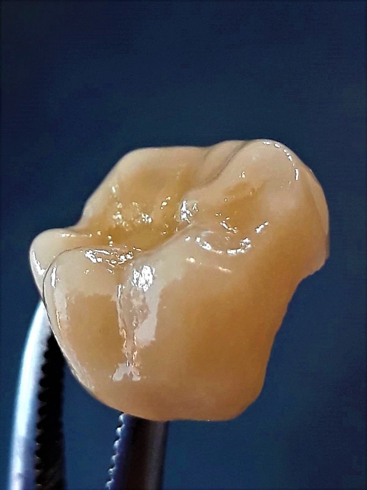 Finishing CAD/CAM Restorations | Dental CAD/CAM | DENTALXS